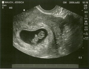 ultrasound 1
