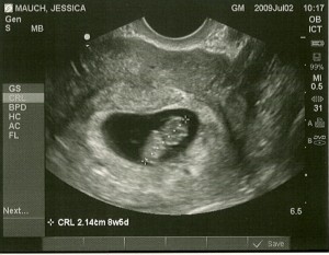 ultrasound 2
